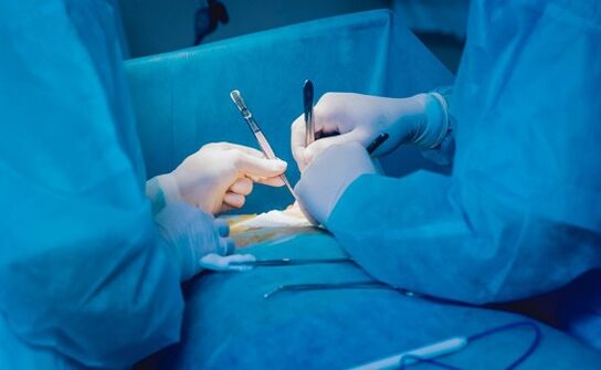 Εκτέλεση χειρουργικής επέμβασης διεύρυνσης πέους